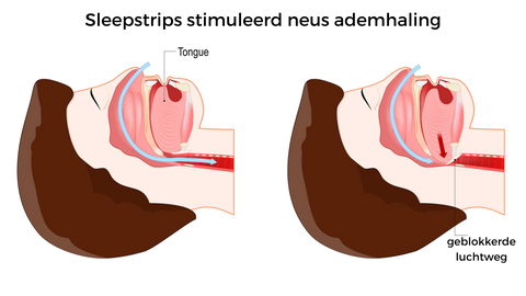 SleepStrips (60 stuks)
